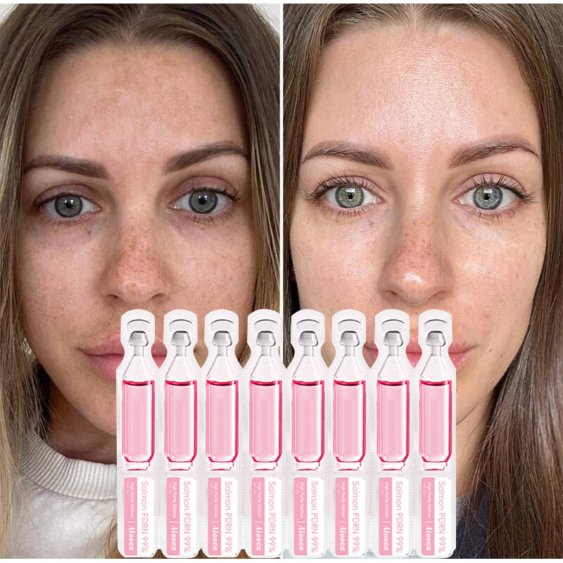연어 세럼 단백질 펩타이드 에센스 2ml X 10개 노 - Peptide Complex Serum 리뷰 및 가격