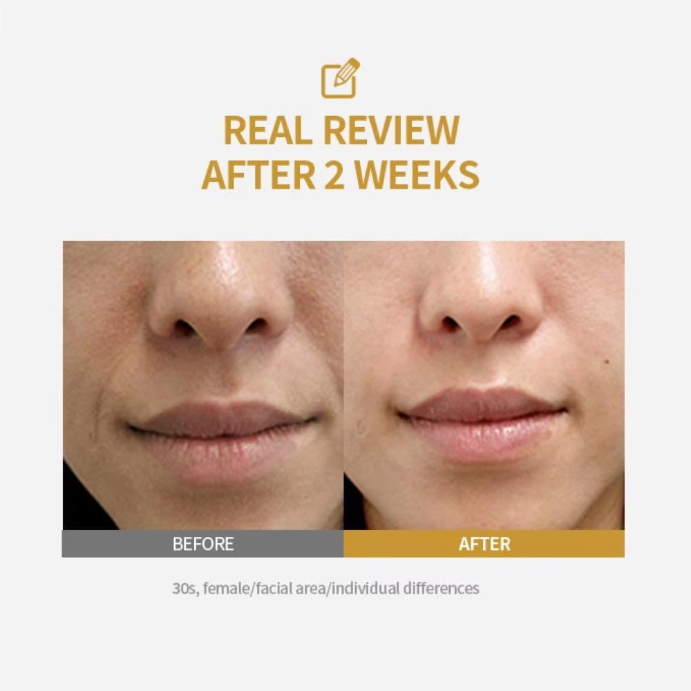 펩타이드 인텐시브 리프팅 앰플, 딥 콜라겐 페이스 퍼밍 - Peptide Complex Serum 리뷰 및 가격
